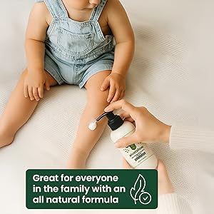 family safe non-toxic after sun lotion for babies kids and sensitive skin sunburn relief