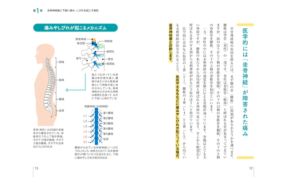 完全図解 坐骨神経痛 | 井須 豊彦, 金 景成 |本 | 通販 | Amazon
