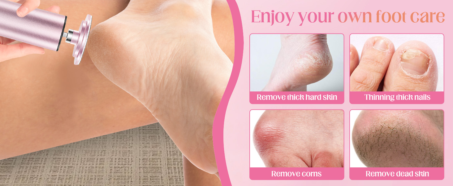 foot callus remover electric, foot callus remover electric, electric foot sanders for feet