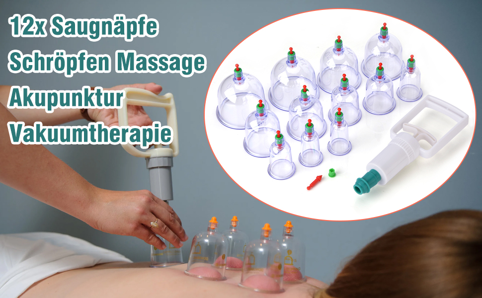 Yosoo Transparente Chinesisches Massage Schröpfen aus Kunststoff mit ...