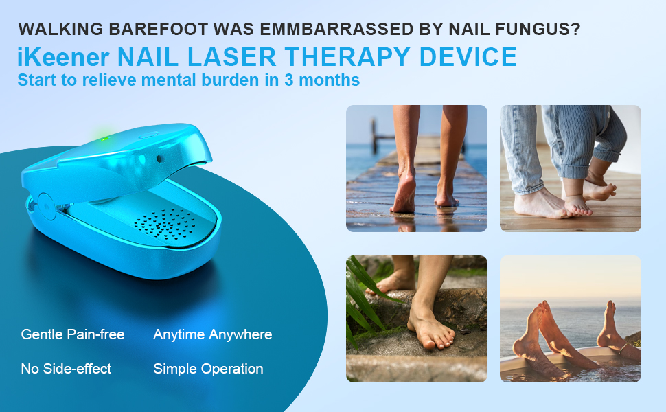 iKeener nail laser therapy device satrt to relieve mental burden in 3 months