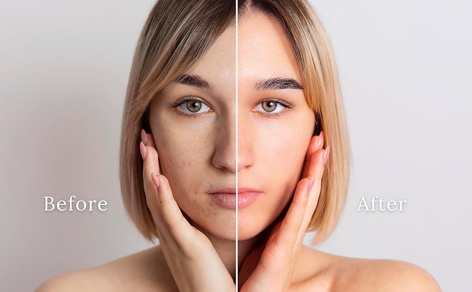 image showing before after benefits of the product snail mucin serum