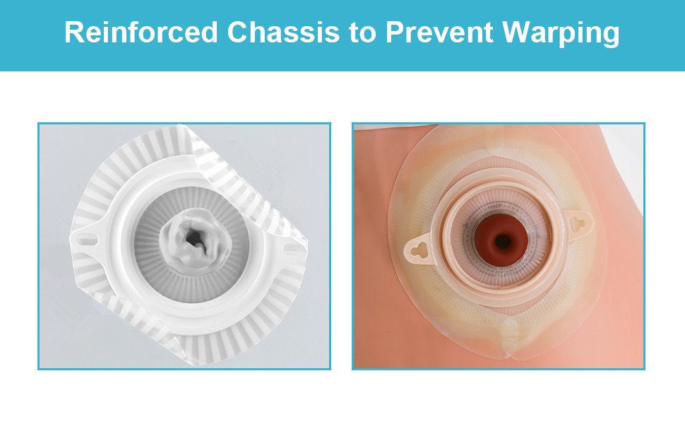 Ostomy Barrier Strips