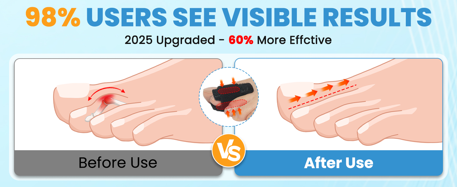 hammer toe corrector for women