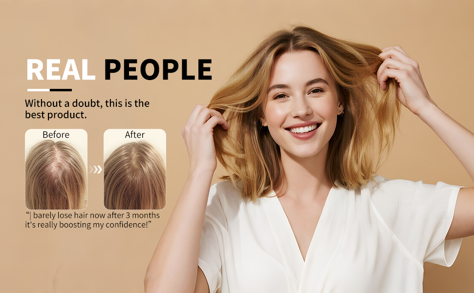 Minoxidil for men and women