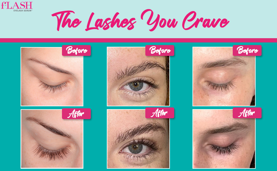 flash eyelash serum, flash cosmetics, long lashes, natural length, volume, definition 