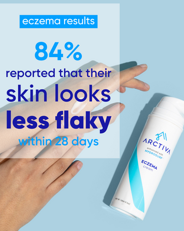 dyshidrotic eczema cream baby eczema cream cream for eczema on face