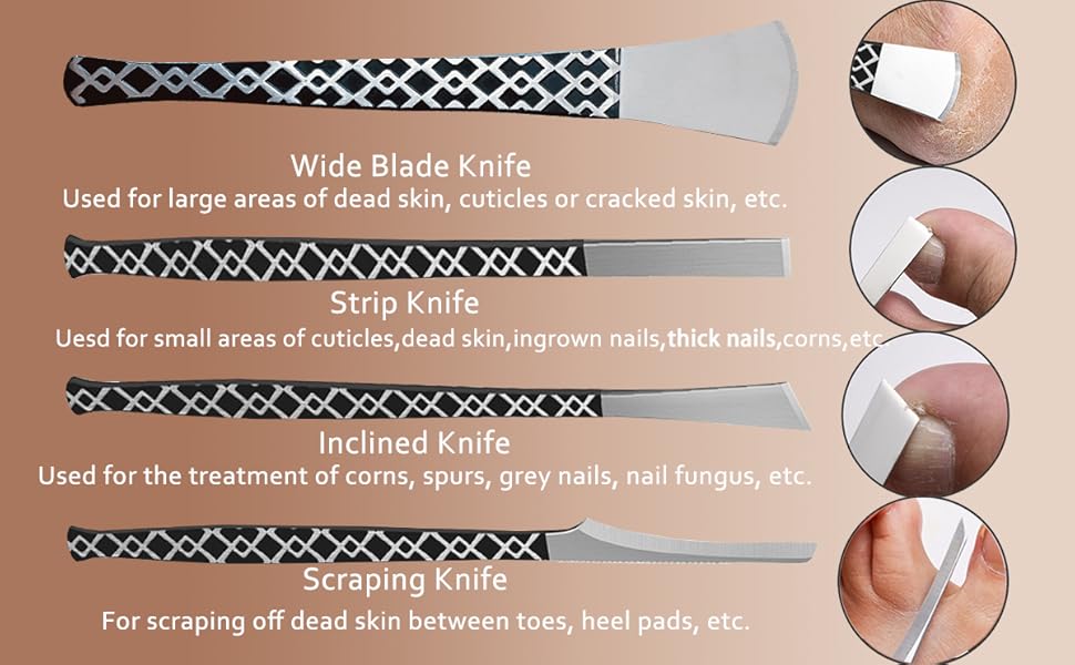 ingrown toenail knife