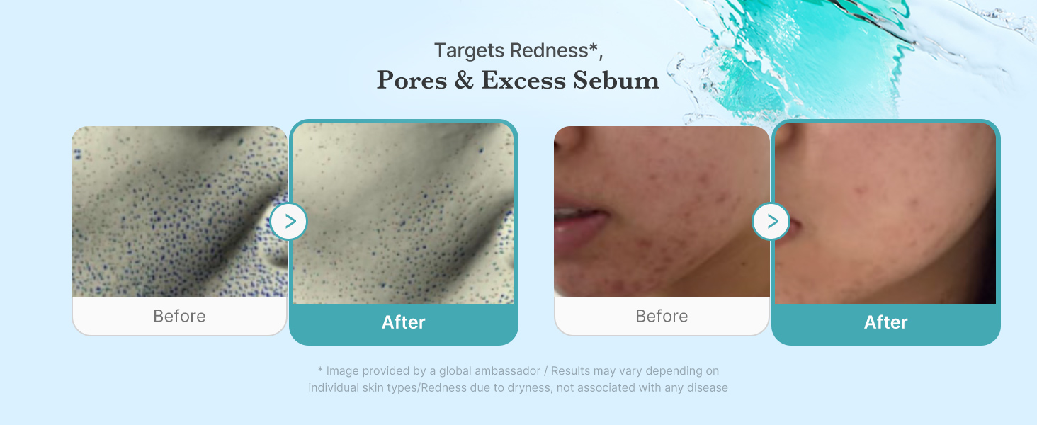 Before and after results