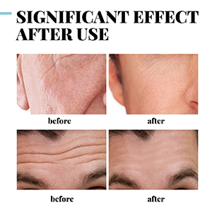 Tighten pores and reduce fine lines