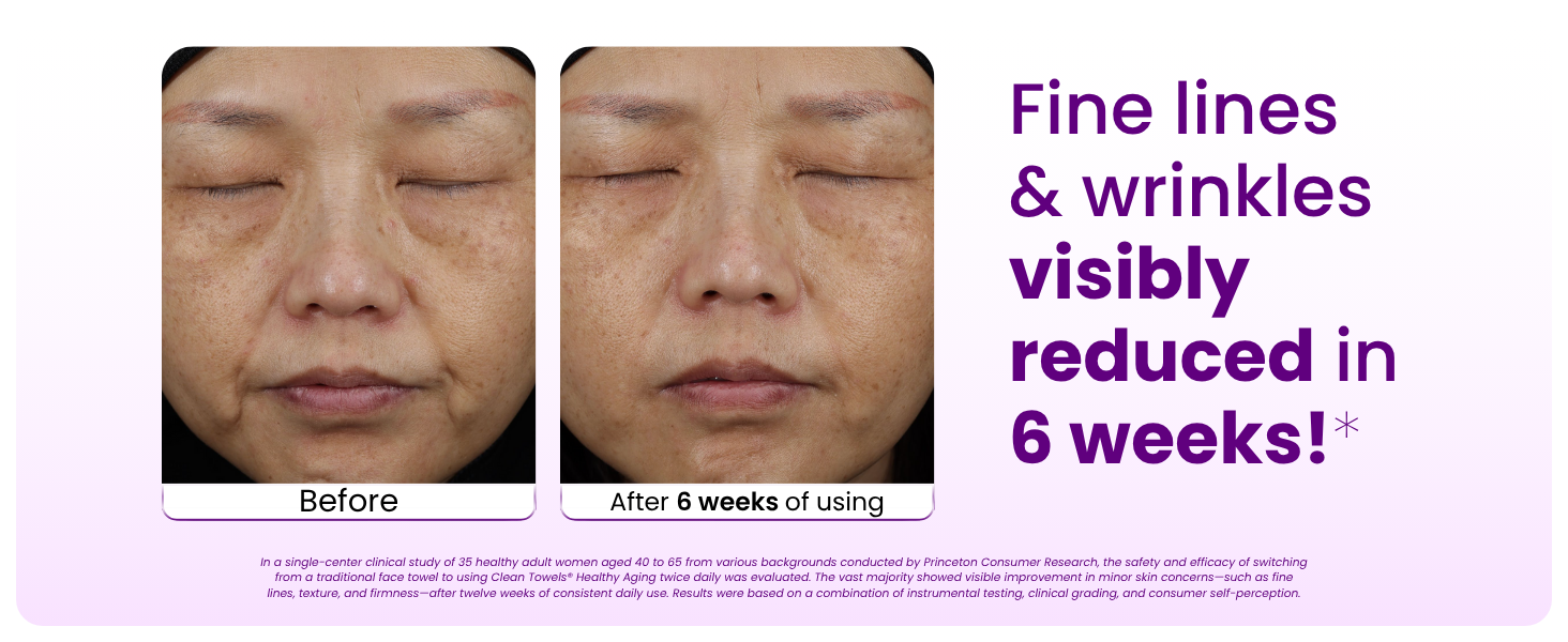 Fine lines and wrinkles visibly reduced in 6 weeks