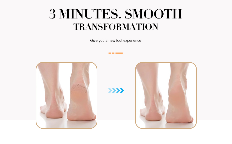 Professional-grade callus treatment