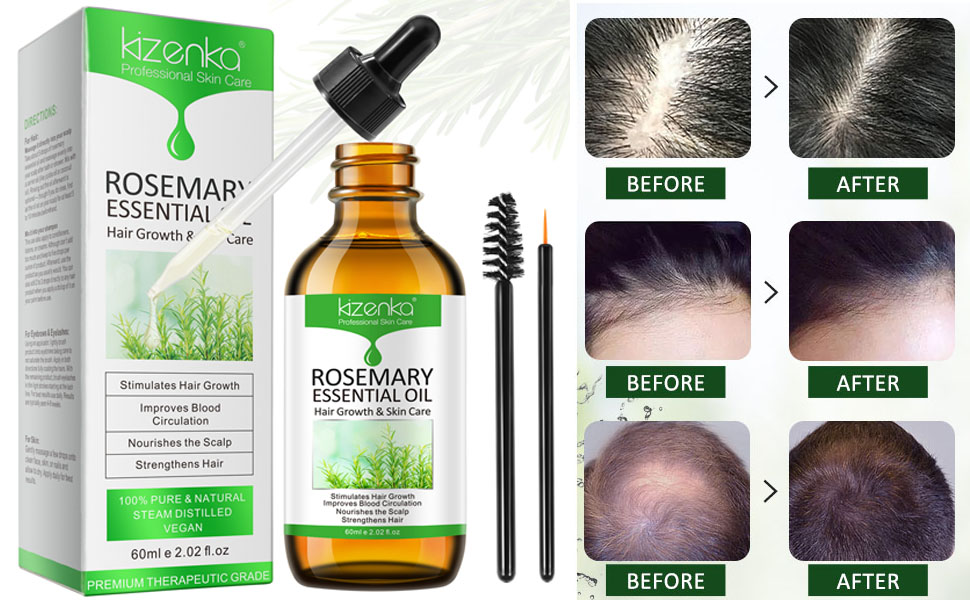 rosemary oil for hair growth