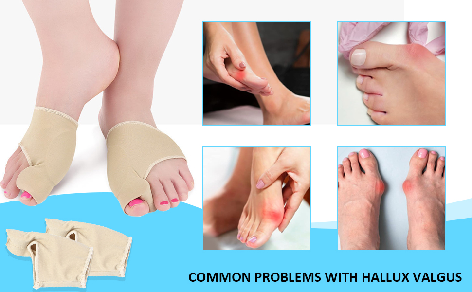 hallux valgus korrektur schiene socken bandage ballenzehen bunion corrector zehenspreizer
