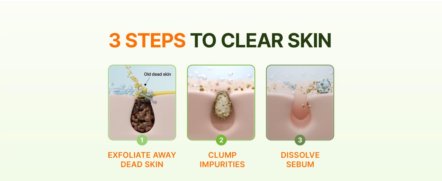 Madeca Matcha Toning Peeling Gel - EBC - 5.2