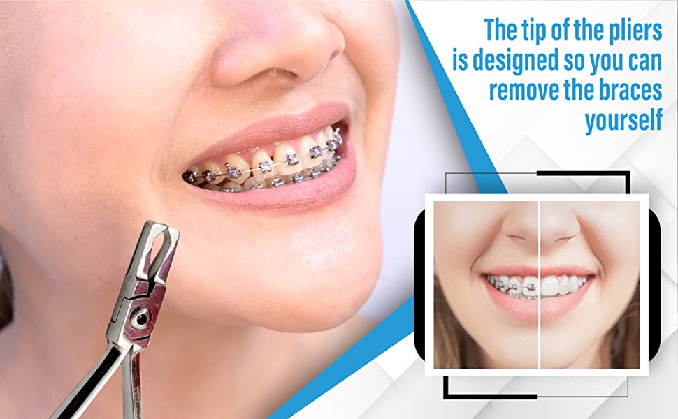 Braces Removing Bracket Removing Ligature Tie Removal Orthodontic Bundle Health