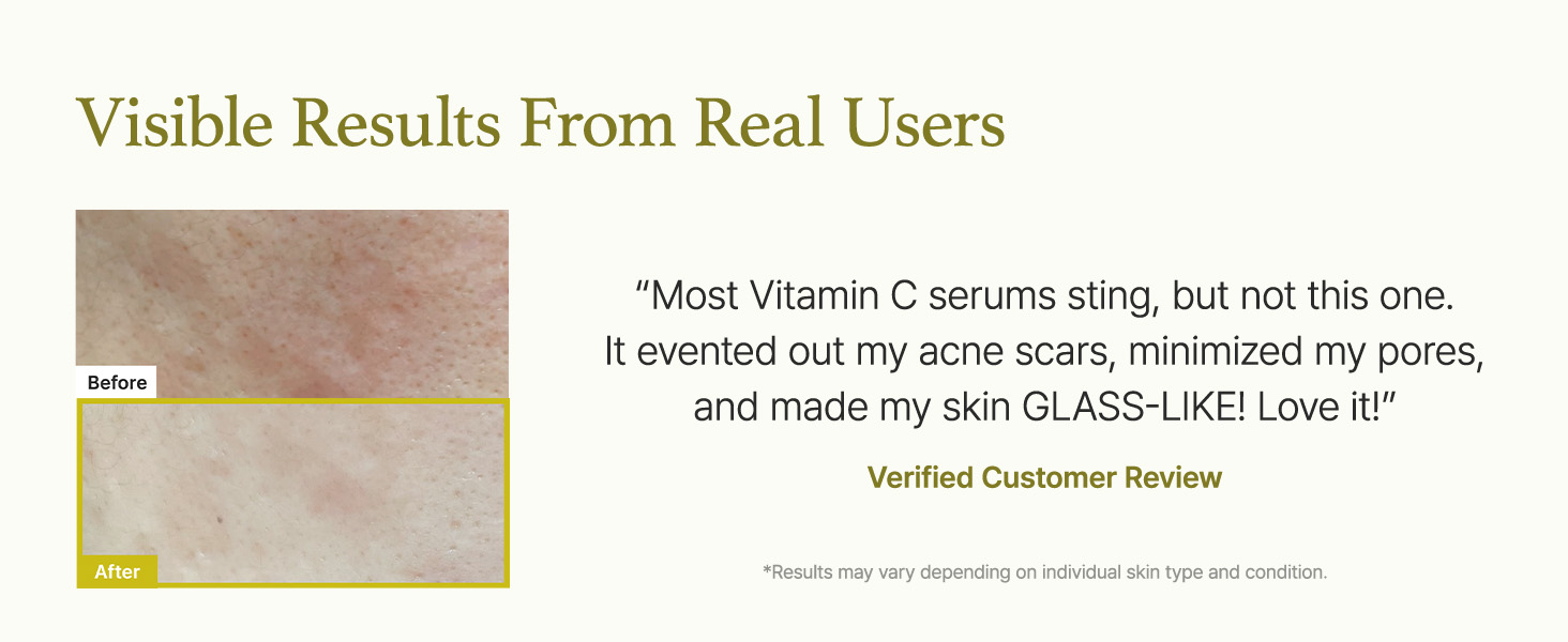 Arencia vitamin c booster serum