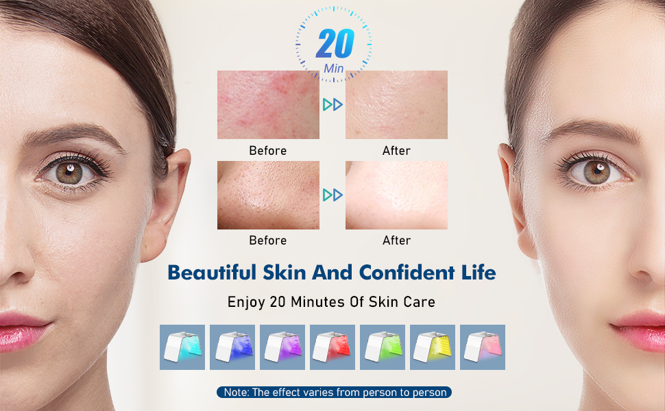 beauty machine for face