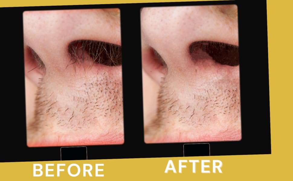 Ozwax Nose Wax Kit for Women Nose Hair Waxing Kit for Men Nose Wax