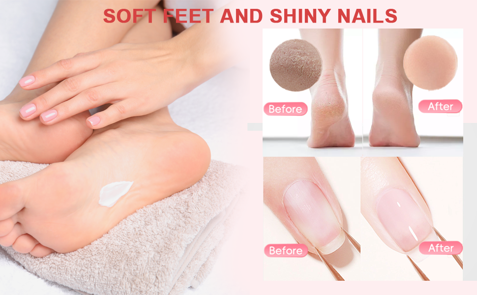 2 in 1 Electric Foot Callus Remover, Aluminum Alloy