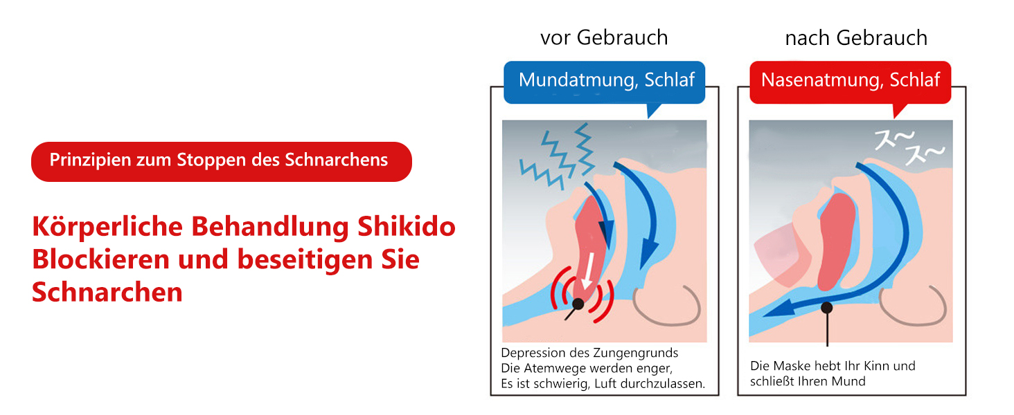 Schnarch Reduzierung Gurt, Anti Schnarchen Kinnriemen, Schnarchstopper Schnarch Lösung