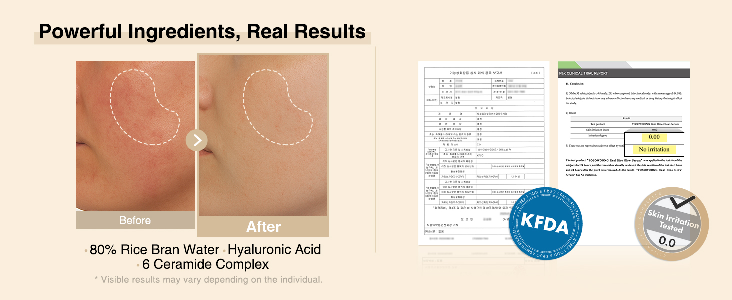 Real Rice Glow Serum(B0F3NGVP3Y)