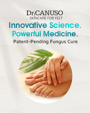 cracked heels cracked feet foot 