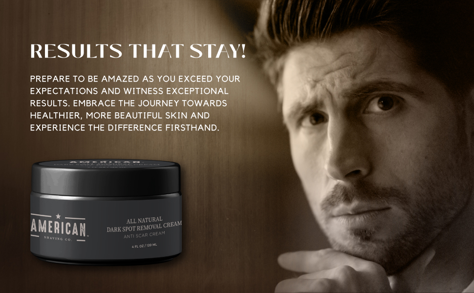 American Shaving Co. Dark Spot Removal Cream 4 Oz