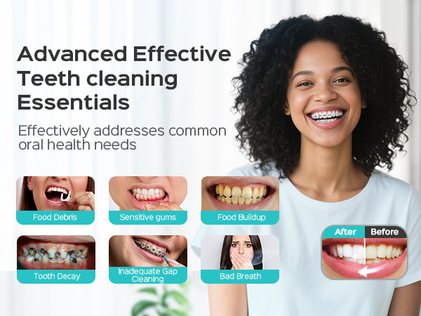 Dental care advertisement showing six before/after images of common oral health issues, including tooth decay and gum problems.