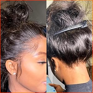 natural hairline all around