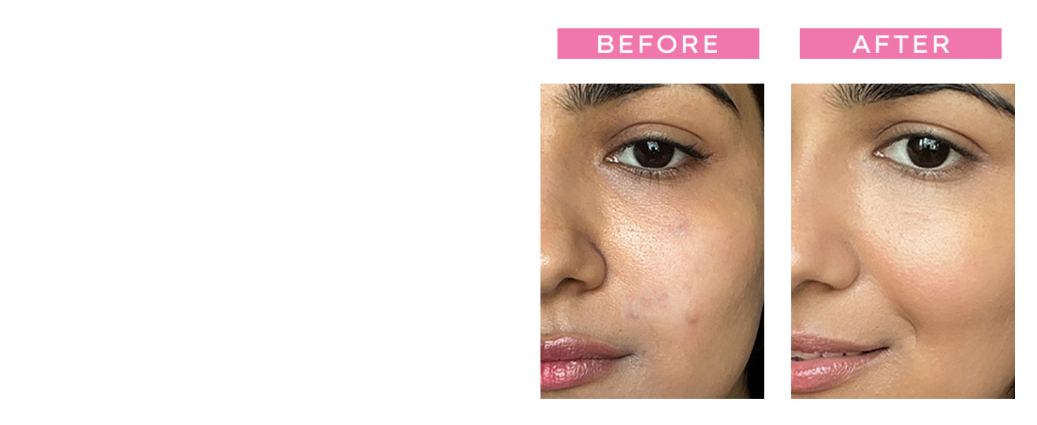 face serum face cream night routine for women men skin face care products dry oily skin brightens 