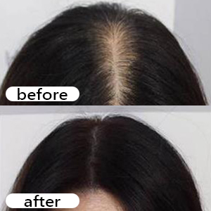 hair growth for girl