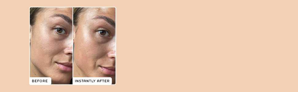 Vitamin C Cream Before and After