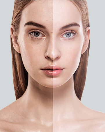 Before and after