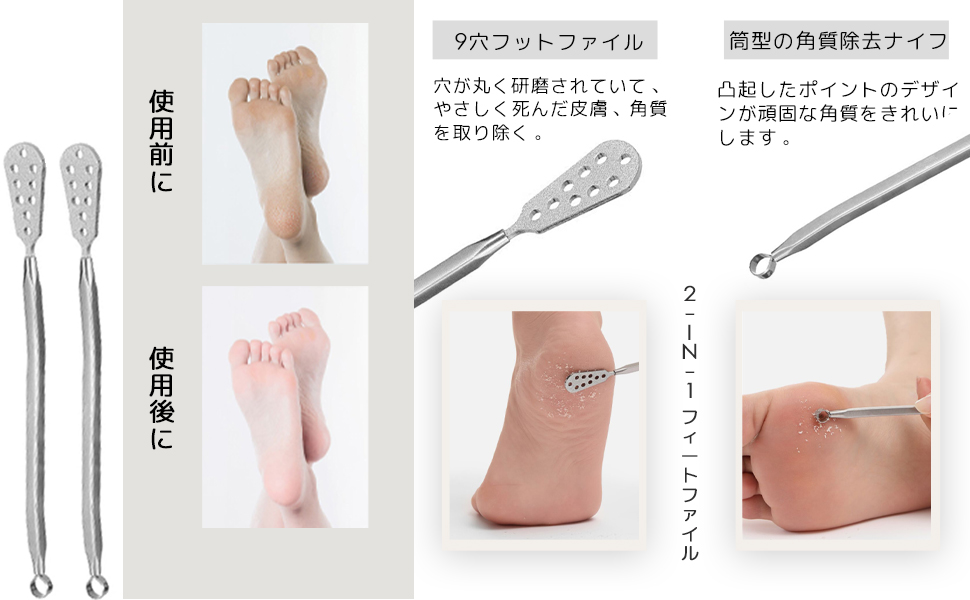 Amazon | DEVENTORZ 角質削り 【2個入り】角質リムーバ 魚の目