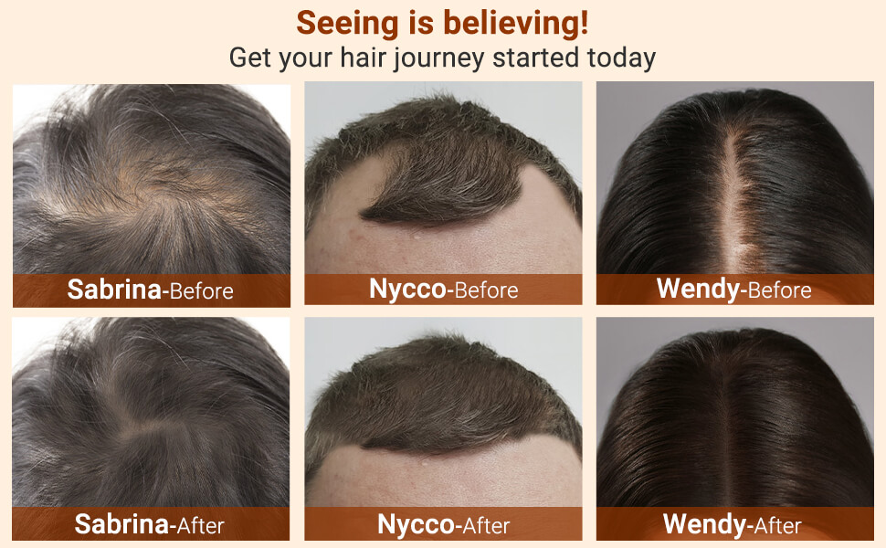 hair growth serum women