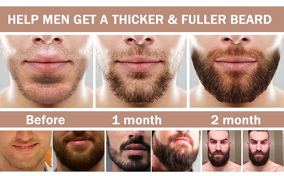 microneedling roller