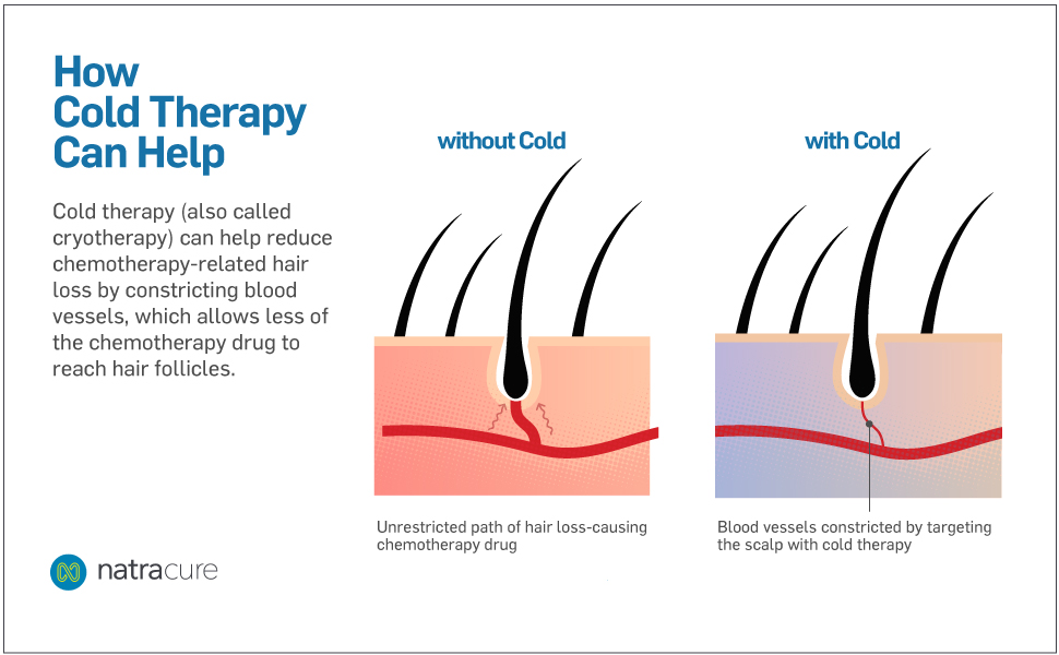 how cold therapy can help