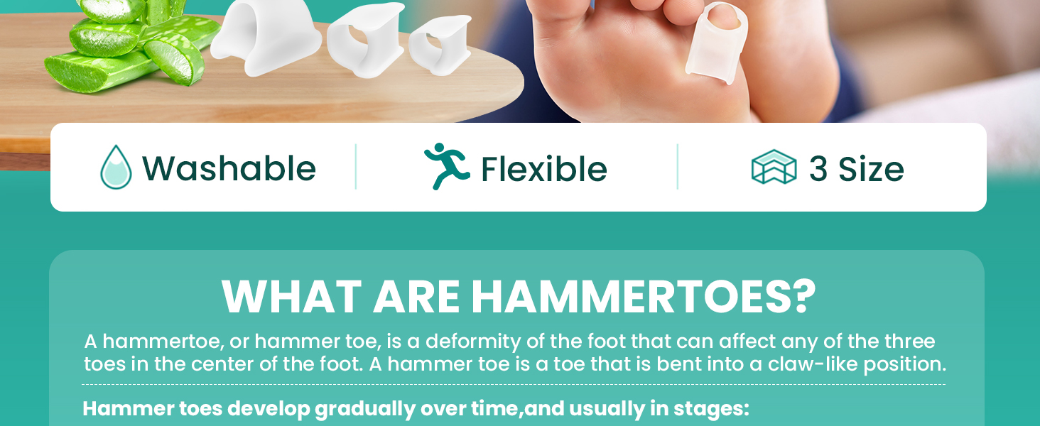 hammer toe