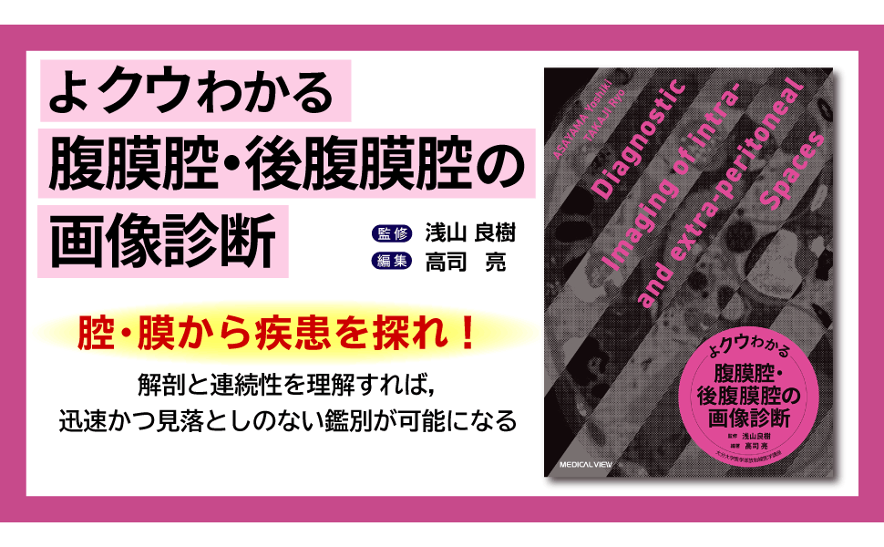 【裁断済み】腹膜腔・後腹膜腔の画像診断、頭頸部間隙の画像診断 裁断済み】腹膜腔・後腹膜腔の画像診断、頭頸部間隙の画像診断