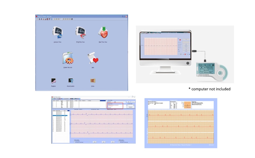 ChoiceMMed Handheld ECG Monitor MD100B Amazon.sg Electronics