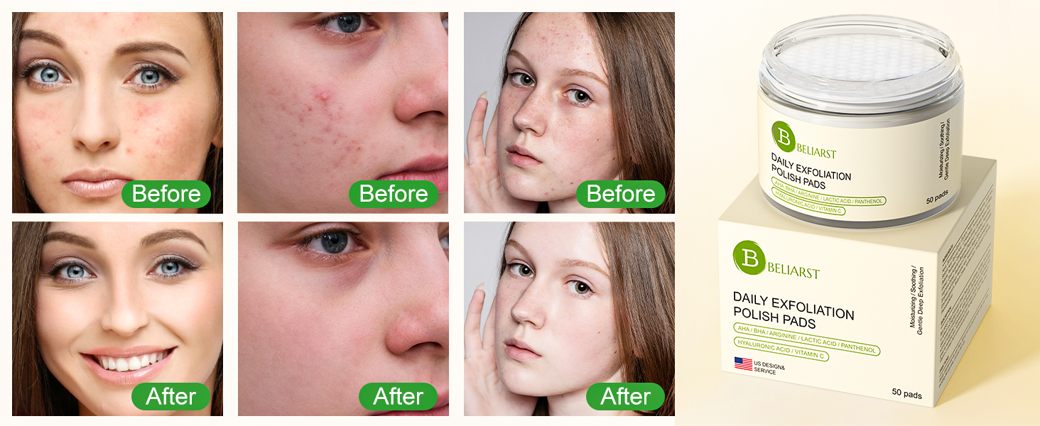 glycolic acid pads