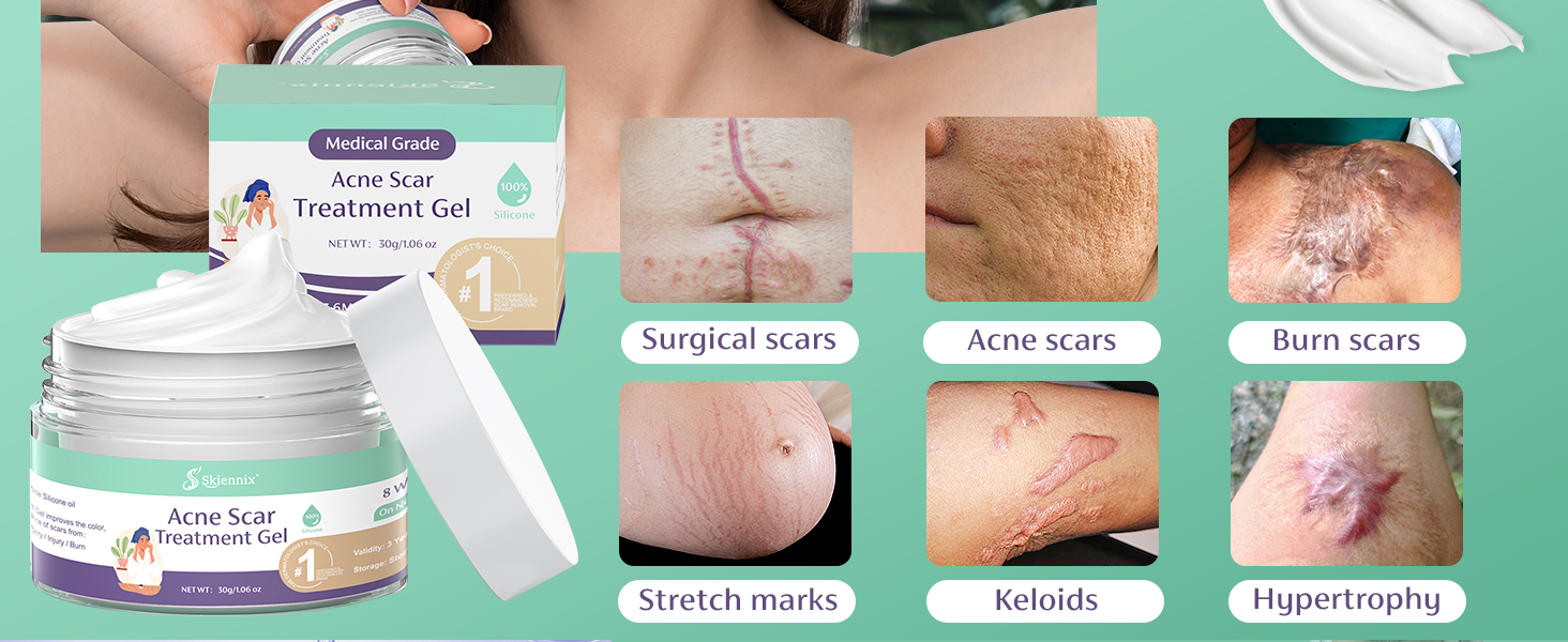 Acne scal treatmen for new and old acne