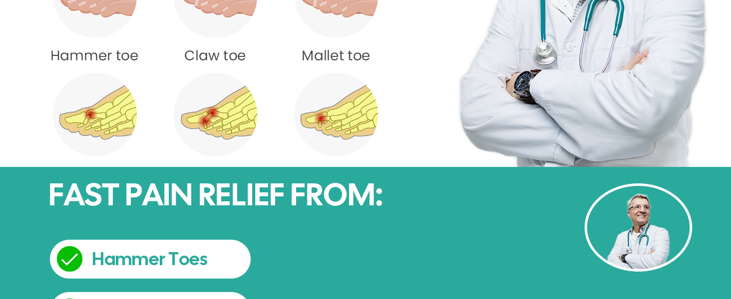 toe straighteners for curled toes