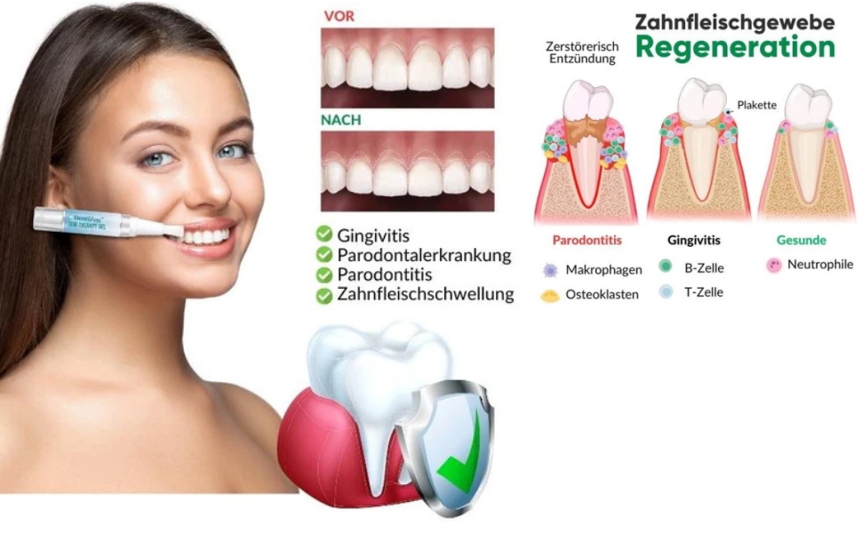 2023 New Dentizen Gum Therapy Gel, Dentizen Gum Disease Treatment Pen