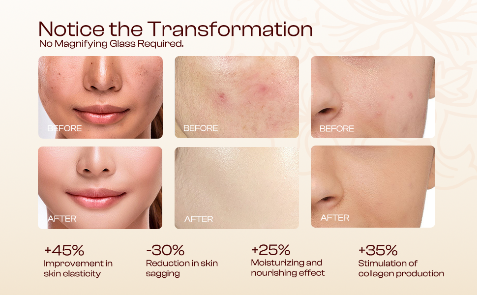Tightening neck cream
