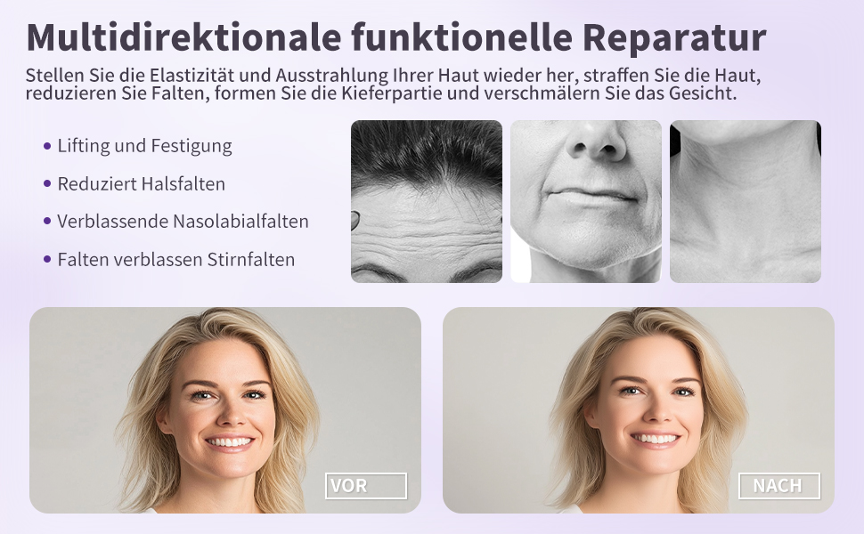 nek gezichtsverstevigingsapparaat
