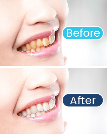 Show Your Confident Smile!