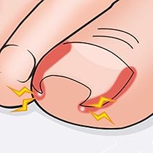 cuticle trimmer with cuticle pusher