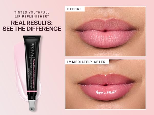 Amazon.com: Revision Skincare YouthFull Lip Replenisher